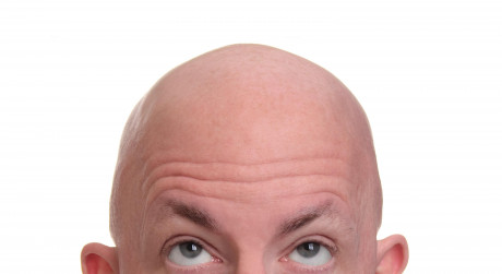 From Baldness To Hair Growing On Your Palms Common Myths