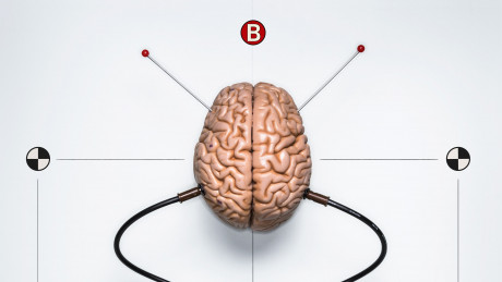 Inside The Race To Build A Brain Machine Interface And Evolution